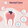 Dental Care Infographics Banner with Teeth Problem Royalty Free Stock Photo