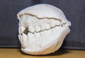 Dental cast