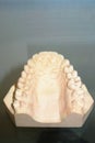 Dental cast Royalty Free Stock Photo