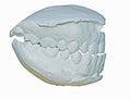 Dental cast Royalty Free Stock Photo