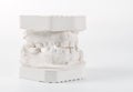 Dental casting gypsum model of human jaws. Crooked teeth and distal bite. Shots were made before treatment with braces . Technical Royalty Free Stock Photo