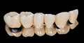 Dental ceramic bridge Royalty Free Stock Photo