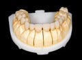 Dental ceramic bridge Royalty Free Stock Photo