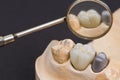 dental ceramic crown Royalty Free Stock Photo