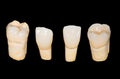 Dental ceramic crowns