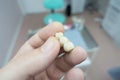 Dental ceramic metal bridges in the hands