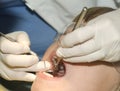 Dental Check-up Royalty Free Stock Photo