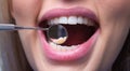 Dental clinic. Teeth examined at dentists. Healthy woman teeth and a dentist mouth mirror. Ideal teeth. Dental tools ant Royalty Free Stock Photo