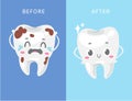 Dental concept of unhealthy and healthy white tooth with dental health care cartoon vector illustration for children Royalty Free Stock Photo