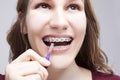 Dental Concepts. Caucasian Teenage Girl Using Bristle Brush for Cleaning Braces and Teeth.Posing With Mouth Open