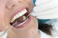 Dental Consultation Royalty Free Stock Photo