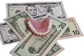 Dental costs Royalty Free Stock Photo