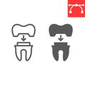 Dental crown line and glyph icon, dental and stomatolgy, tooth crown sign vector graphics, editable stroke linear icon