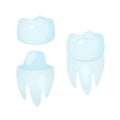 Dental crowns and implantation