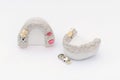 Dental crowns isolated on a white background. Orthopedic dentistry background. ceramic-metal dental bridges Royalty Free Stock Photo