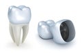 Dental crowns and tooth