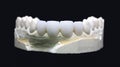 Zirconium crowns on a black background