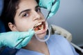 Dental cure Royalty Free Stock Photo