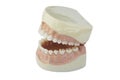 Dental Royalty Free Stock Photo