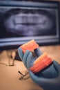 Dental denture or teeth presented on a blue rubber glove, x-ray