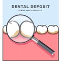 Dental deposit - row of tooth under magnifying glass
