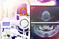 Dental digital tomograph Royalty Free Stock Photo