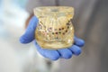 Dental doctor demonstrating teeth replica with braces on it