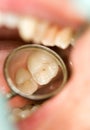 Dental exam Royalty Free Stock Photo