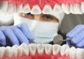 Dental examination concept, Inside mouth view. Soft focus Royalty Free Stock Photo