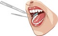 Dental examination illustration