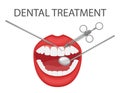 Dental examination and treatment of teeth with a mirror and tools. Professional preventive dental appointment. An open mouth with