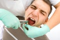 Dental extraction