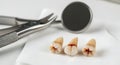 Dental extraction tools and extracted teeth on a white surface Royalty Free Stock Photo