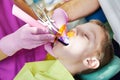 Dental filing of child tooth by ultraviolet light