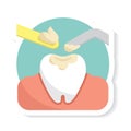 dental filling on tooth. Vector illustration decorative design