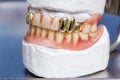 Dental gold teeth prosthesis, clay mold human gums model