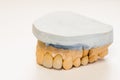 Dental gypsum model in dentist laboratory office - close-up. Gypsum Dentures with porcelain teeth isolated on white background