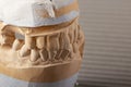 Dental gypsum model. Mould of human teeth. Oral health concept. Close up