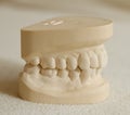 Dental gypsum model mould of teeth