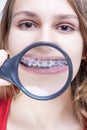 Dental Health and Hygiene Concepts. Caucasian Female Demonstrating Teeth
