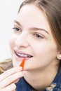 Dental Health Ideas and Concepts.Closeup Portrait of Caucasian Female Teenager With Teeth Braces. Royalty Free Stock Photo