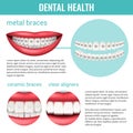 Dental Health Infographics Royalty Free Stock Photo