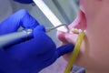 Dental hygienist makes ultrasonic cleaning pours teeth with water, closeup view.