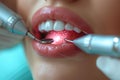 Dental hygienist using ultrasonic scaler for thorough teeth cleaning and plaque removal Royalty Free Stock Photo