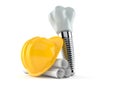 Dental implant with blueprints