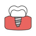 Dental implant color icon Royalty Free Stock Photo