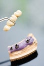 Dental implant head and bridge Royalty Free Stock Photo