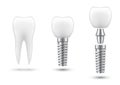 Dental implant, healing abutment or cap, crown. Artificial tooth, stages of implantation.