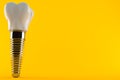 Dental implant