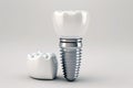 Dental implant model of molar tooth as a concept of implantation teeth Royalty Free Stock Photo